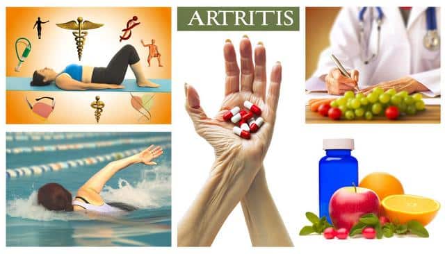 A collage related to arthritis: woman exercising, swimming, hand holding pills, doctor writing near fruits, and a vitamin bottle with fruits.