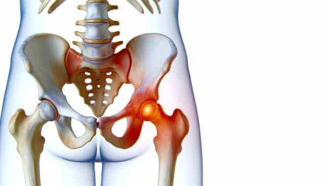 Illustration of pelvic bones with a glowing pain point at the right hip joint.