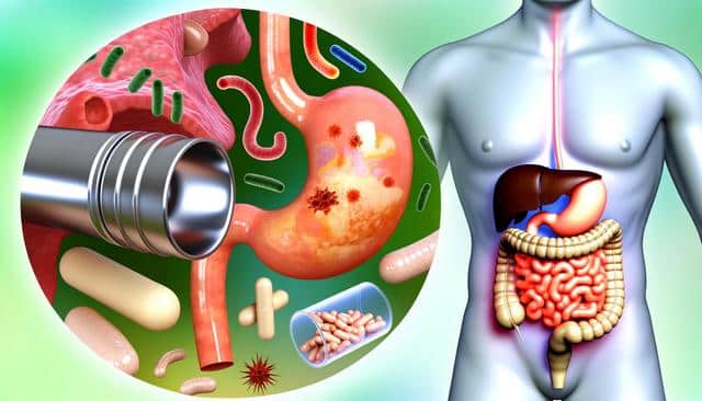 Anatomical illustration showing abdominal organs with a close-up of a stomach, bacteria, and pills.