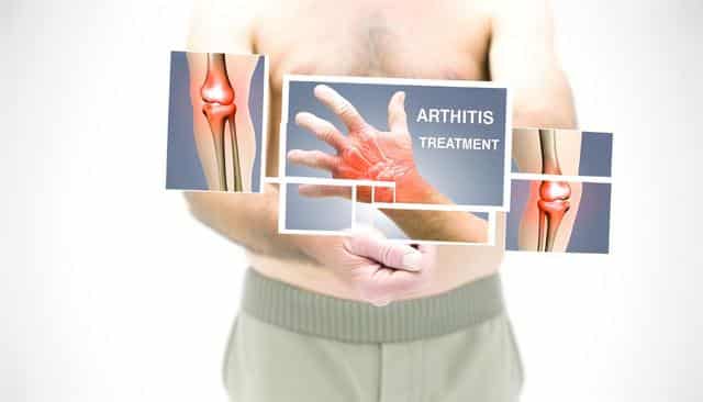 Collage featuring inflamed joints and hand with "Arthritis Treatment" text.