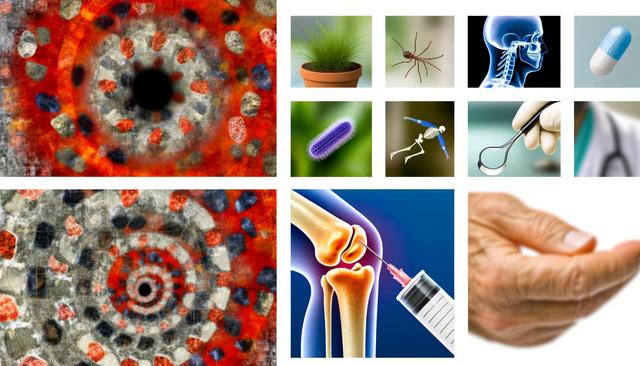 Abstract red and gray pattern, plant, spider, X-ray, pill, bacteria, skeleton, medical tools, knee injection, hand.