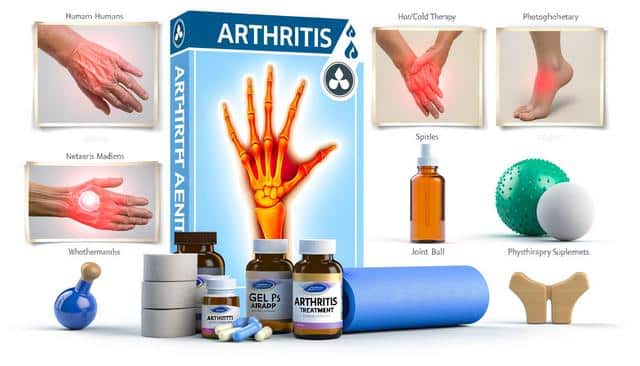 Collage showing arthritis treatments: creams, pills, therapy tools, and images of affected hands and feet.