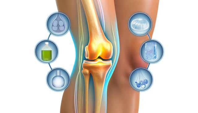 Illustration of a glowing knee joint with surrounding icons of cells, a green liquid, and ice.